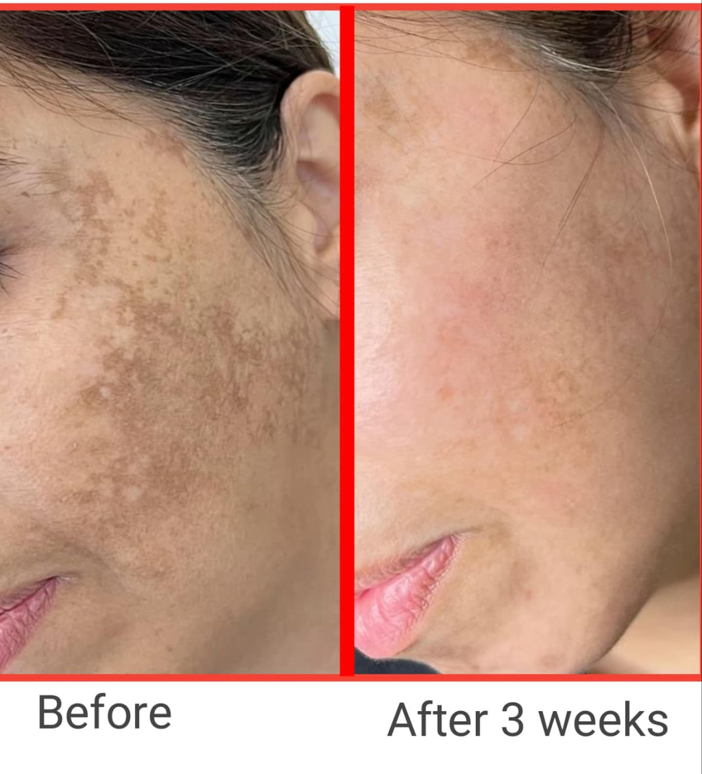 Vyanora Kumkumadi Glow Facepack – Ayurvedic Skin Brightening Treatment