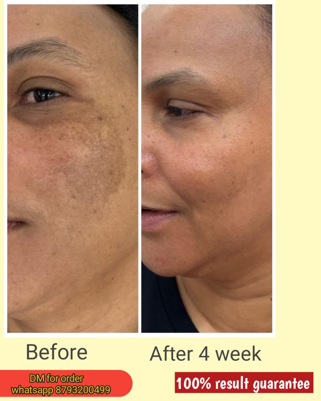 Vyanora Kumkumadi Glow Facepack – Ayurvedic Skin Brightening Treatment