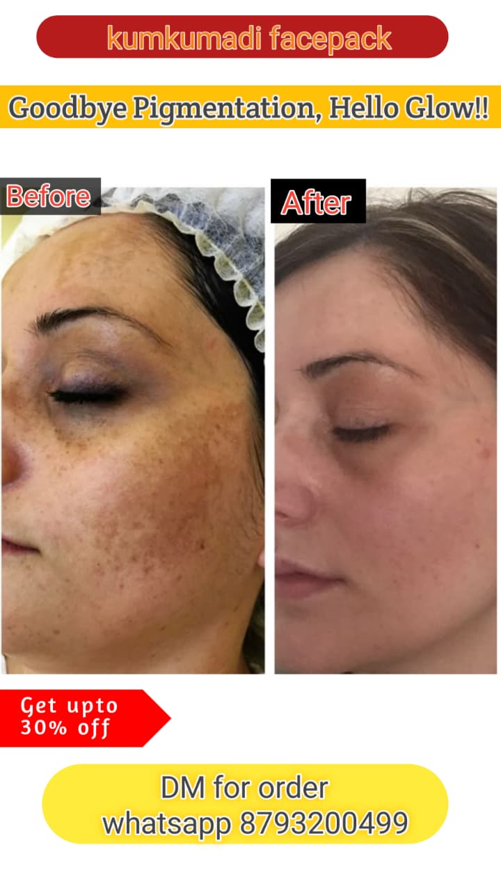 Vyanora Kumkumadi Glow Facepack – Ayurvedic Skin Brightening Treatment